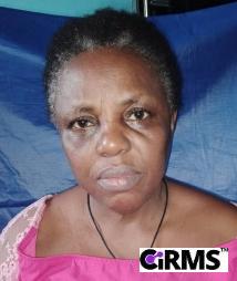 Mrs. Odira Francisca Onyemefolu